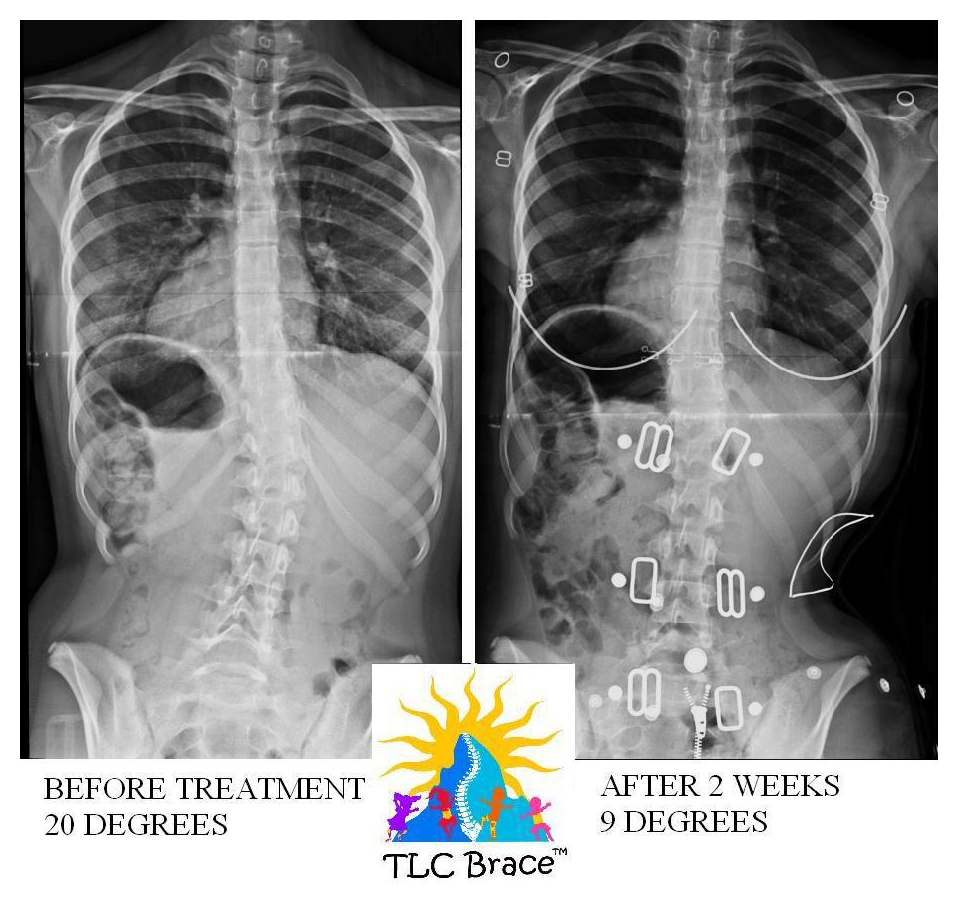 tlc_comparison1