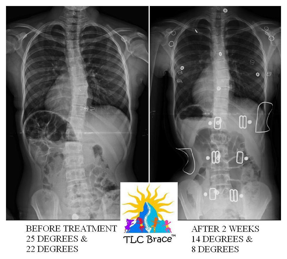 tlc_comparison4