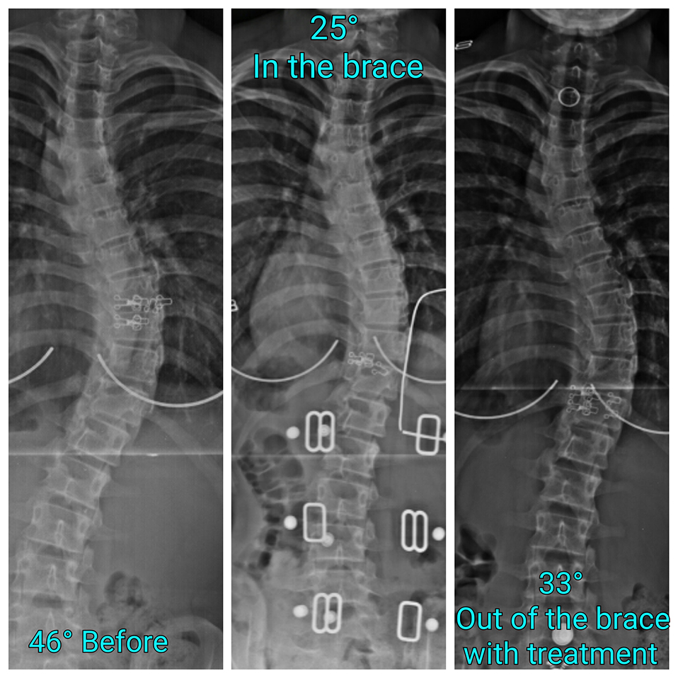 tlc_comparison6