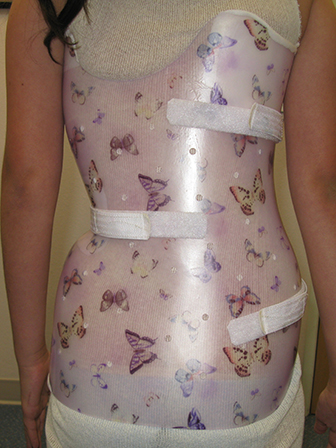 Back